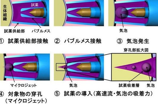 日本女教授发明无针头注射器:打针不再疼-奇闻